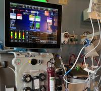 New CRRT Technology in ICU